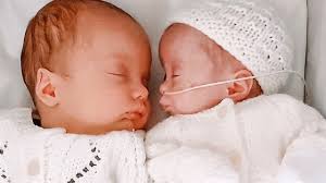 Miracle superfetation twins Noah and Rosalie get a sibling