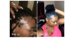 Box braids are a great protective style because there's no thermal heat on the hair, which means your hair won't have any issues growing. How To Regrow Edges Naturally