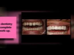 They said the money could be used toward any cosmetic procedure, but that a lot of people used it to replace missing teeth and, . Cosmetic Dentistry Grants Youtube