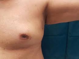 वैसे तो सभी जानते है, शराब स्वास्थ्य जे लिए हानिकारक है, तथा इसका अत्यधिक recent posts. Breast Cancer Awareness Month à¤ª à¤° à¤· à¤® à¤¬ à¤° à¤¸ à¤Ÿ à¤• à¤¸à¤° à¤• 6 à¤²à¤• à¤·à¤£ à¤¦ à¤¸à¤° à¤²à¤• à¤·à¤£ à¤®à¤¹à¤¸ à¤¸ à¤¹ à¤¨ à¤ªà¤° à¤¤ à¤° à¤¤ à¤œ à¤ à¤¡ à¤• à¤Ÿà¤° à¤• à¤ª à¤¸