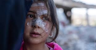 Civilians bear the brunt in Baalbek