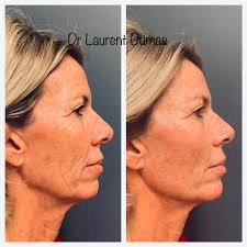 Docteur Laurent Dumas