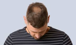 The truth is that the majority of us don't take action against hair loss until our hair is noticeably thin. Hairatin Hair Building Fibers And Aging Hair Solutions For Men Women Hairatin