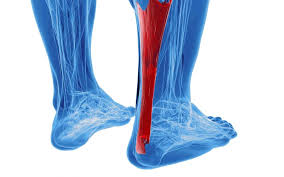 Check spelling or type a new query. Achilles Tendon Injuries Are Worse Than You Think Aoa Orthopedic Specialists