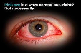 Isnt Pink Eye Caused by Somebody Farting on Your Pillow? Er, No… - StoryMD