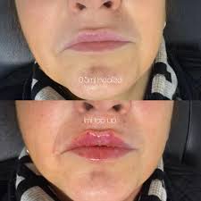 Alex Jackson (@skingymaesthetics) • Instagram photos and videos