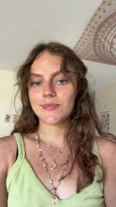 Smith Amish Eczema M