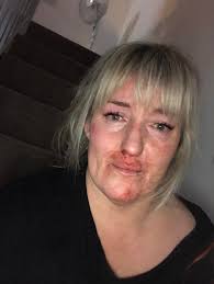 Woman brutally attacked while walking dog near Stroud