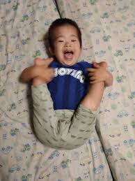 ウエスト症候群(点頭てんかん)ダイくんの体験談① | ダウン症児を育てるパパ、ママ皆に向けたネット配信の情報番組『ダウン症TV』のブログ