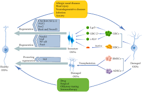 Image result for Drug-Induced Olfactory Dysfunction