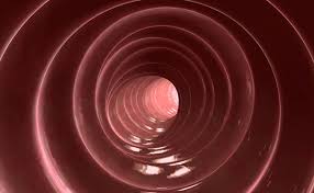 Image result for Microscopic Colitis