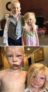 Animals - This boy named Bridger Walker saved his little sister by standing  between her and a charging dog. He said "If someone had to die, I thought  it should be me"