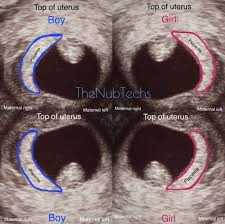 Nub The Nub Tech Baby Shower Baby Nub Shower Tech Baby Gender Prediction Baby Life Hacks Baby Gender