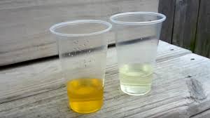15 Homemade Pregnancy Tests That Work Parentinghealthybabies