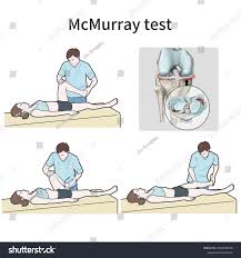 Image result for McMurray Test