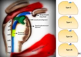 Normal anatomy, variants and checklist. A New Significance Of An Old Structure Aponeurotic Expansion Of Supraspinatus Tendon And Its Relationships With Biceps Brachii Long Head And Rotator Cuff Tendons European Journal Of Radiology