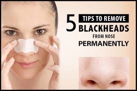 5 Tips to Remove Blackheads from Nose Permanently | Vedicline