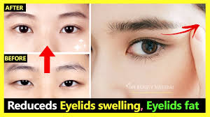 You need to wash your eyes with ice cold water or you can make use of ice cubes and gently rub on your closed eyelid skin around the eyes. How To Reduce Eyelids Swelling Eyelids Fat Make Eyes Bigger Naturally Japan Eyes Massage Youtube