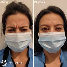 Skin Plus (@skinplusco) • Facebook