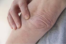 For those with crepey skin, this ingredient has been shown to diminish wrinkles over time, making it one of the best at keeping the skin looking young. 5 Ways To Get Rid Of Crepey Skin Fashionistha