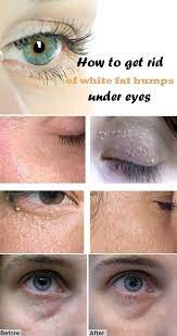 Maybe you would like to learn more about one of these? Pin On Ogt Blogger Friends