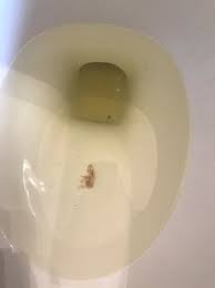 Lost My Mucus Plug Babycenter