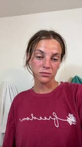 Hallie Beaver's Instagram, Twitter & Facebook