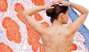 However, melanomas (or cancerous moles) tend to appear blurred or irregular around the outside edges. Skin Cancer Symptoms How To Tell The Difference Between Cancerous And Non Cancerous Moles Express Co Uk