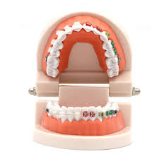 1 Adet Dis Dis Modeli Seramik Braket Metal Arch Tel Ogretim Egitim Dis Modeli Bukkal Tup Ligature Baglari Dis Araclari Dis Model Beyin Aliexpress