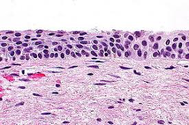 Maybe you would like to learn more about one of these? Uterine Cervix With Atrophic Changes Libre Pathology