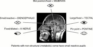 Image result for Coma Exam