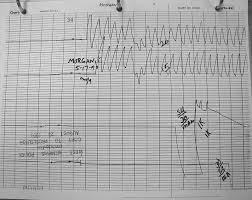 christoper morgan polygraph charts may 17 1993