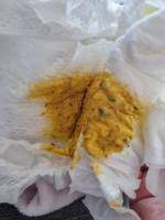 Dunkelbrauner bis schwarzer stuhlgang ist kein grund zur sorge, wenn er auf eine der genannten ursachen der schwarze stuhl entsteht in diesem fall durch blutungen im oberen verdauungstrakt: Vorsicht Bild Schwarze Punkte Km Stuhl Forum Baby Urbia De