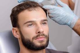 Alma TED Hair Restoration