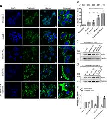 Sy lim is on mixcloud. Lamin A C And Emerin Depletion Impacts Chromatin Organization And Dynamics In The Interphase Nucleus Bmc Molecular And Cell Biology Full Text