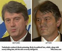 Low levels have uncertain effects and may even verify suspected dioxin poisoning with toxicological testing. Dioxin Vergiftung Biosophie