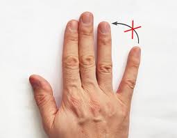 Most fractures are caused by a bad fall or automobile accident. Furnicaturi Si Amorteli In Maini Si Degete Tratament Dr Vladislav Gyebnar