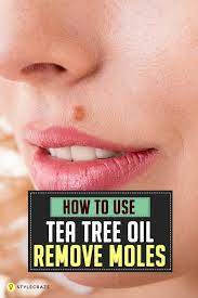 How To Use Tea Tree Oil For Mole Removal Methods And Precautions Get Rid Of Warts Warts On Face Skin Moles