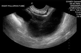 Check spelling or type a new query. Abdominal Pain In Nonpregnant Female Patients 2014 04 06 Ahc Media Continuing Medical Education Publishing