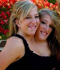 They do not share a heart, stomach, spins, lungs or spinal cord. 9 Facts About Abby And Brittany That Show There S More To Them Than Their Appearance