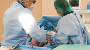 Caesar merupakan proses melahirkan dari ibu hamil tanpa melalui jalur lahir pada umumnya, melainkan melalui operasi pembedahan pada perut dan rahim. Cara Berani Operasi Caesar Jika Tidak Bisa Melahirkan Normal