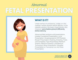 Image result for Shoulder Presentation