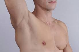 Breast cancer risk in men is increased by elevated blood levels of estrogen, previous radiation exposure, and a family history of breast cancer. Breast Cancer In Men Rare But Fatal