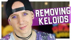 You may have been a victim of keloid on nose or keloid earlobe. Piercing Bump 6 Ways To Get Rid Of Cartilage Or Nose Keloid Blister