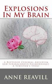 Explosions In My Brain A Ruptured Cerebral Aneurysm And Subarachnoid Haemorrhage A Survivor S Story Eboo Cerebral Aneurysm Subarachnoid Hemorrhage Hemorrhage