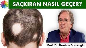 Sackiran Nedir Sackiran Sebepleri Sackiran Sarimsak Kuru Sac Guzellik Sakal