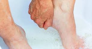Slideshow What Is Plantar Fasciitis What Is Plantar Fasciitis Plantar Fasciitis Plantar Fasciitis Remedies