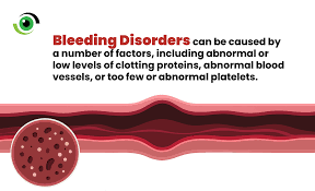 Image result for Bleeding Disorder