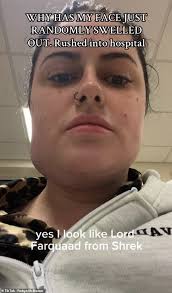 I paid £5,000 for liposuction to tackle my double chin