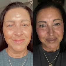 Contouring for a slimmer, dimensional face